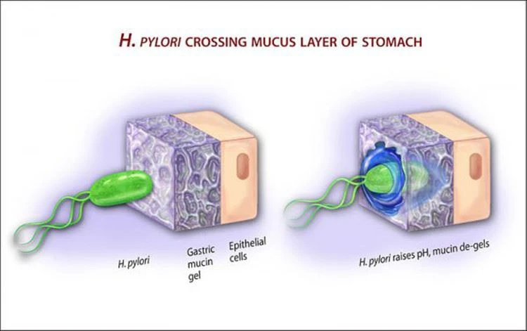 H Pylori Crossing Mucus Layer of Stomach H Pylori Crossing Mucus Layer of Stomach